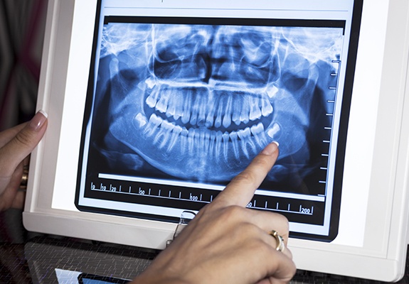 Digital x-rays on computer screen