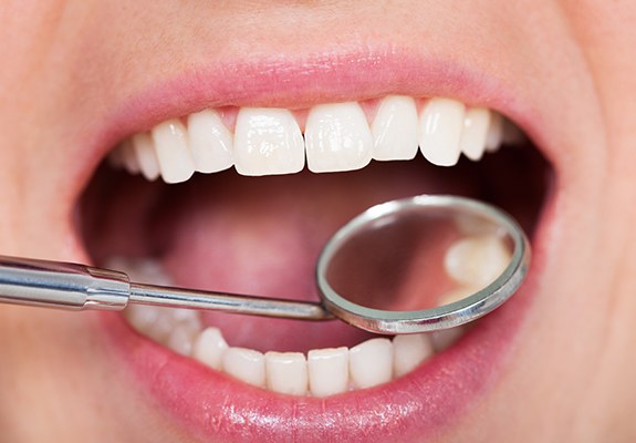 Dentist examining smile after all ceramic dental restorations