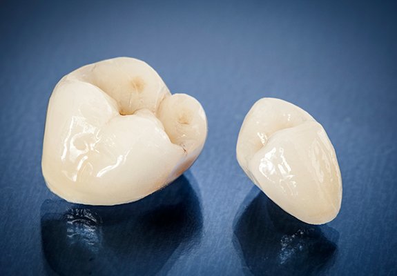 Two dental crowns prior to placement