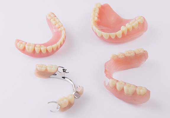 Four types of dentures