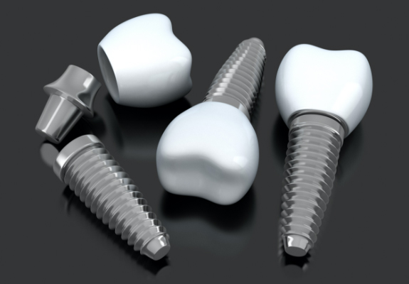 Three animated dental implant supported dental crowns