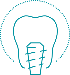 Animated dental implant