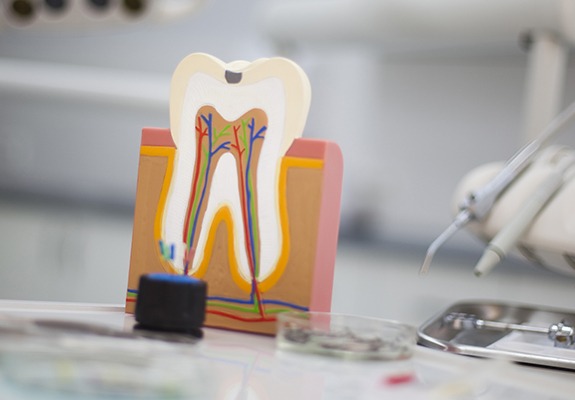 Model of inside of a tooth used to demonstrate root canal therapy