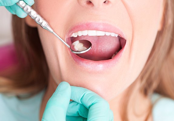 Patient receiving dental sealants