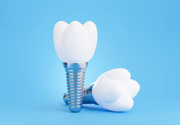 Two dental implants on a blue background