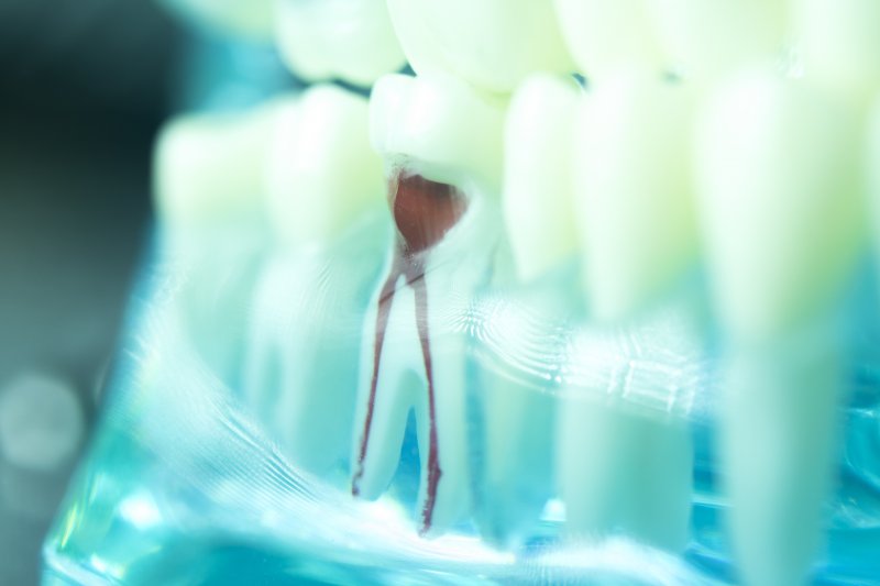 Digital illustration of root canal