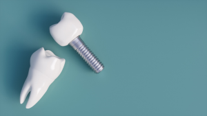 a closeup of a dental implant 