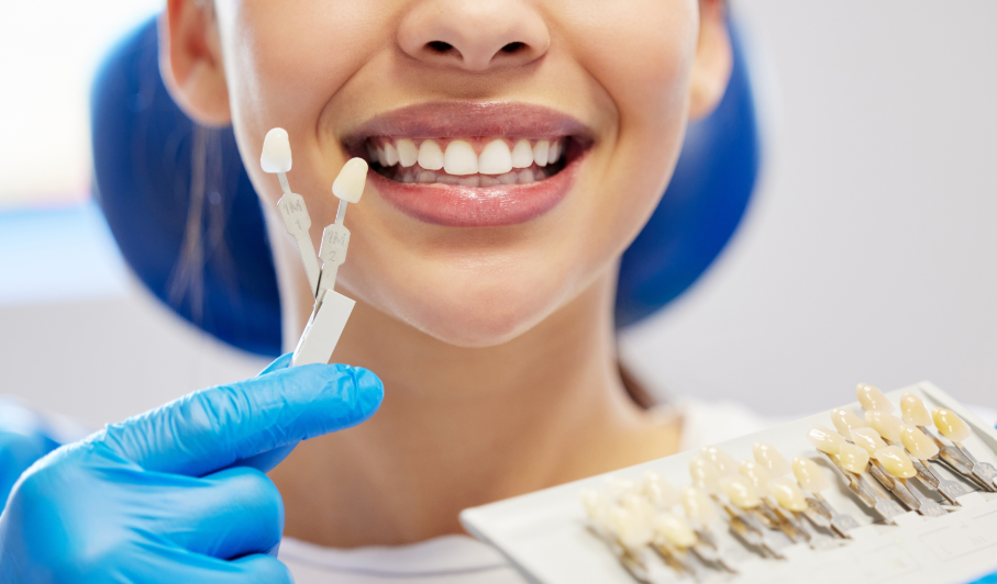 Close up of woman's smile and veneers